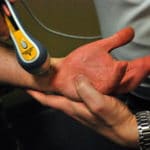 Cold Laser Joint Therapy, Fishers, IN