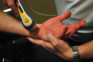 Cold Laser Joint Therapy, Fishers, IN